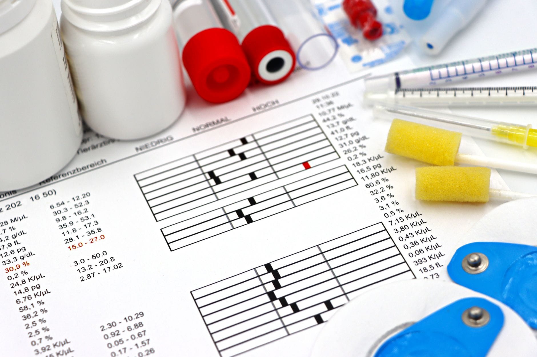 Czy warto badać poziom witaminy D przed suplementacją i jak czytać wyniki Sprzęt medyczny, wyniki badań i dane zdrowotne na stole klinicznym